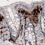 CD142 Antibody in Immunohistochemistry (Paraffin) (IHC (P))