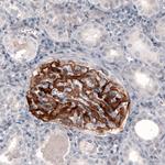 CD142 Antibody in Immunohistochemistry (Paraffin) (IHC (P))