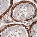 CD142 Antibody in Immunohistochemistry (Paraffin) (IHC (P))