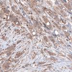 B-Raf Antibody in Immunohistochemistry (Paraffin) (IHC (P))