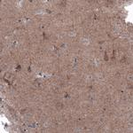 B-Raf Antibody in Immunohistochemistry (Paraffin) (IHC (P))