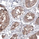 B-Raf Antibody in Immunohistochemistry (Paraffin) (IHC (P))