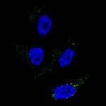 TYRP1 Antibody in Immunocytochemistry (ICC/IF)