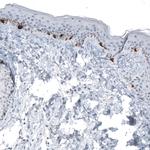 TYRP1 Antibody in Immunohistochemistry (Paraffin) (IHC (P))