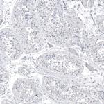 PCP4 Antibody in Immunohistochemistry (Paraffin) (IHC (P))