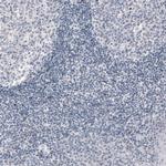 PCP4 Antibody in Immunohistochemistry (Paraffin) (IHC (P))