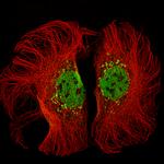 KMT2D Antibody in Immunocytochemistry (ICC/IF)