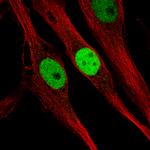 KLF4 Antibody in Immunocytochemistry (ICC/IF)