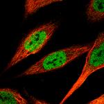 KLF4 Antibody in Immunocytochemistry (ICC/IF)