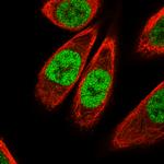 KLF4 Antibody in Immunocytochemistry (ICC/IF)