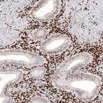 KLF4 Antibody in Immunohistochemistry (Paraffin) (IHC (P))