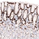 KLF4 Antibody in Immunohistochemistry (Paraffin) (IHC (P))