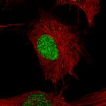 POU3F2 Antibody in Immunocytochemistry (ICC/IF)