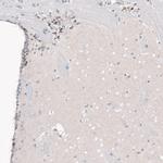 POU3F2 Antibody in Immunohistochemistry (Paraffin) (IHC (P))