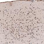 POU3F2 Antibody in Immunohistochemistry (Paraffin) (IHC (P))