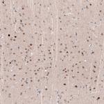 POU3F2 Antibody in Immunohistochemistry (Paraffin) (IHC (P))