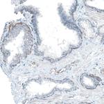 CD49f Antibody in Immunohistochemistry (Paraffin) (IHC (P))