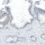 CD104 Antibody in Immunohistochemistry (Paraffin) (IHC (P))