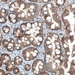 CD104 Antibody in Immunohistochemistry (Paraffin) (IHC (P))