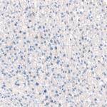 CD104 Antibody in Immunohistochemistry (Paraffin) (IHC (P))