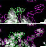 LRP1 Antibody