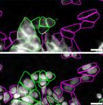 LRP1 Antibody in Immunocytochemistry (ICC/IF)