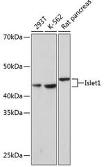 ISL1 Antibody in Western Blot (WB)