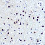 HES1 Antibody in Immunohistochemistry (Paraffin) (IHC (P))