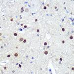 HES1 Antibody in Immunohistochemistry (Paraffin) (IHC (P))