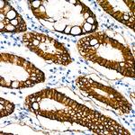 EpCAM Antibody in Immunohistochemistry (Paraffin) (IHC (P))