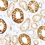 EpCAM Antibody in Immunohistochemistry (Paraffin) (IHC (P))