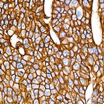 EpCAM Antibody in Immunohistochemistry (Paraffin) (IHC (P))