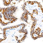 EpCAM Antibody in Immunohistochemistry (Paraffin) (IHC (P))