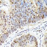 CDK4 Antibody in Immunohistochemistry (Paraffin) (IHC (P))