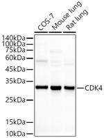 CDK4 Antibody in Western Blot (WB)