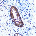 Galectin 3 Antibody in Immunohistochemistry (Paraffin) (IHC (P))