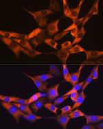 FABP1 Antibody in Immunocytochemistry (ICC/IF)