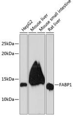 FABP1 Antibody in Western Blot (WB)