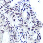 Ku70 Antibody in Immunohistochemistry (Paraffin) (IHC (P))