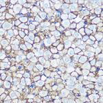 Annexin A2 Antibody in Immunohistochemistry (Paraffin) (IHC (P))