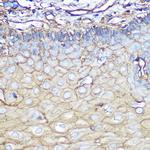 Annexin A2 Antibody in Immunohistochemistry (Paraffin) (IHC (P))