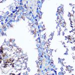 Annexin A2 Antibody in Immunohistochemistry (Paraffin) (IHC (P))