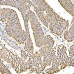 C1QBP Antibody in Immunohistochemistry (Paraffin) (IHC (P))