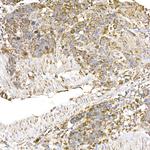 C1QBP Antibody in Immunohistochemistry (Paraffin) (IHC (P))