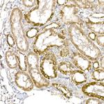 C1QBP Antibody in Immunohistochemistry (Paraffin) (IHC (P))