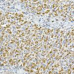 C1QBP Antibody in Immunohistochemistry (Paraffin) (IHC (P))