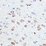 GluR2 Antibody in Immunohistochemistry (Paraffin) (IHC (P))