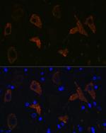 GluR2 Antibody in Immunohistochemistry (Paraffin) (IHC (P))