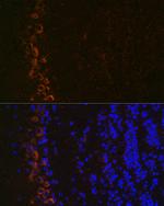 GluR2 Antibody in Immunohistochemistry (Paraffin) (IHC (P))