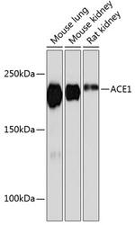 ACE Antibody in Western Blot (WB)